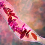 United States approves CRISPR gene-editing to treat sickle cell disease