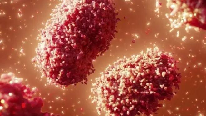 Thailand Reports Suspected Case of New, More Dangerous Mpox Variant 1 Thailand