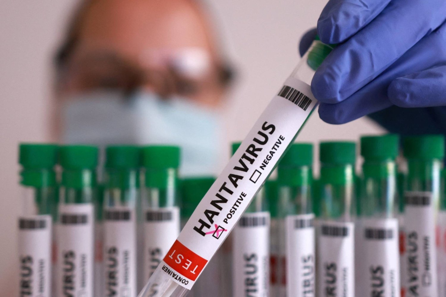 EU Intensifies Efforts to Develop Countermeasures Against Hantavirus 2 Hantavirus
